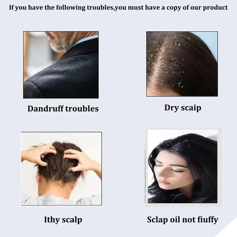 Anti-dandruff Massage Comb - Image 5