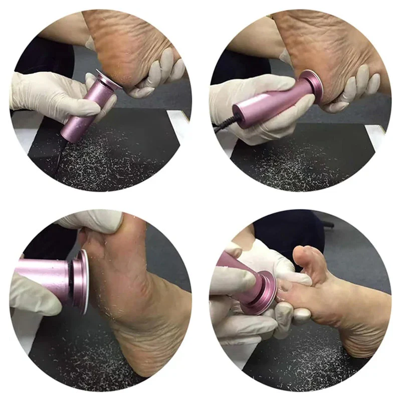 Electric Foot Care Pedicure - Image 5
