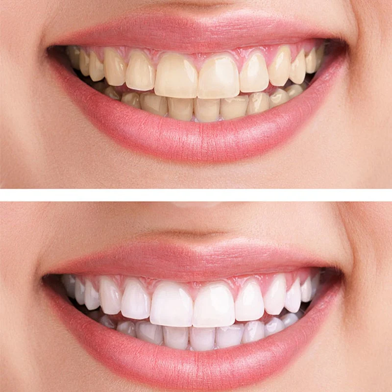 Hydroxyapatite Toothpaste - Image 2