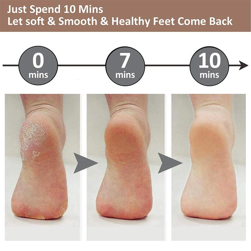 Pedicure Foot File - Image 8