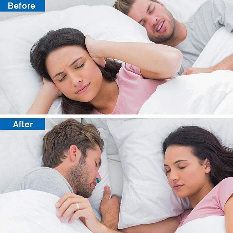 Micro CPAP Anti Snoring Electronic Device - Image 6