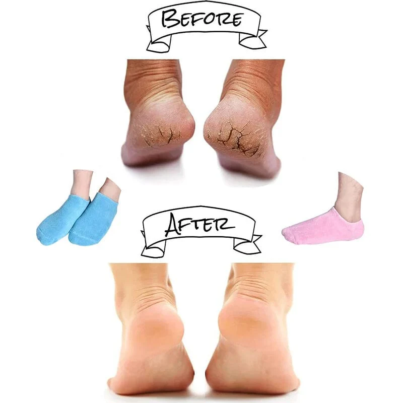 Moisturizing Socks with Gel Lining - Image 6