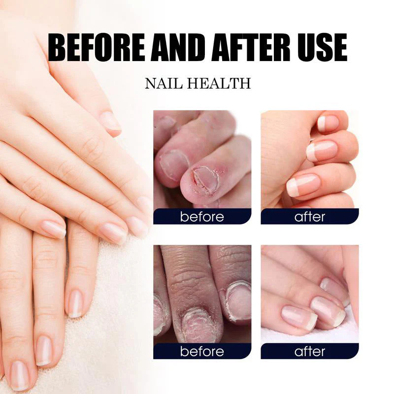 Nail Care Solution - Image 3