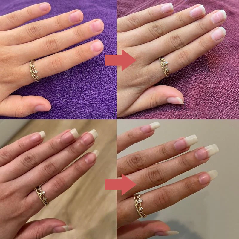 Nails Nutritious Growth Oil - Image 9