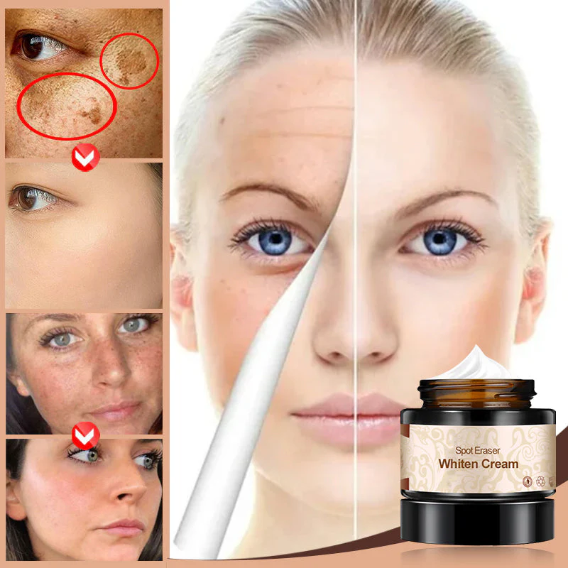 Plant lightening melanin freckle cream - Image 10