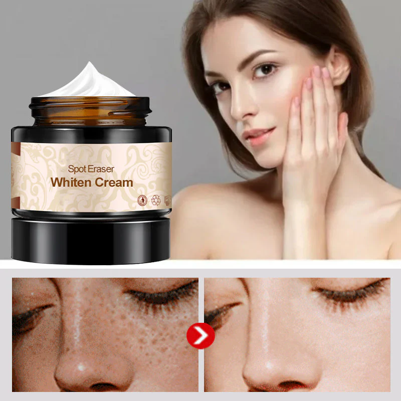 Plant lightening melanin freckle cream - Image 6