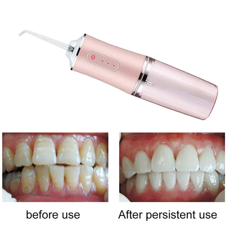 Portable Dental Water Flosser - Image 5