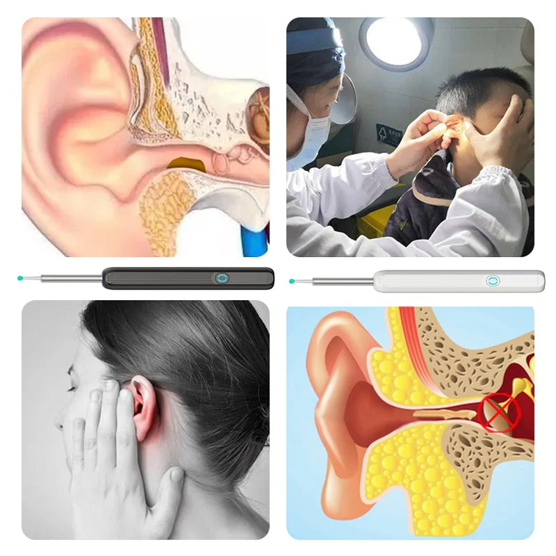 Smart Visible Earpick - Image 10