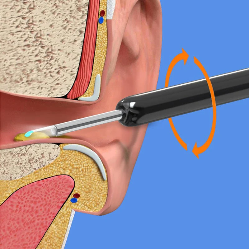Smart Visible Earpick - Image 11