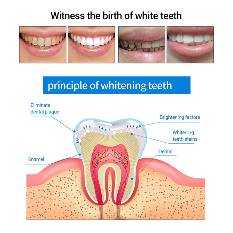 Teeth Whitening Pens - Image 6