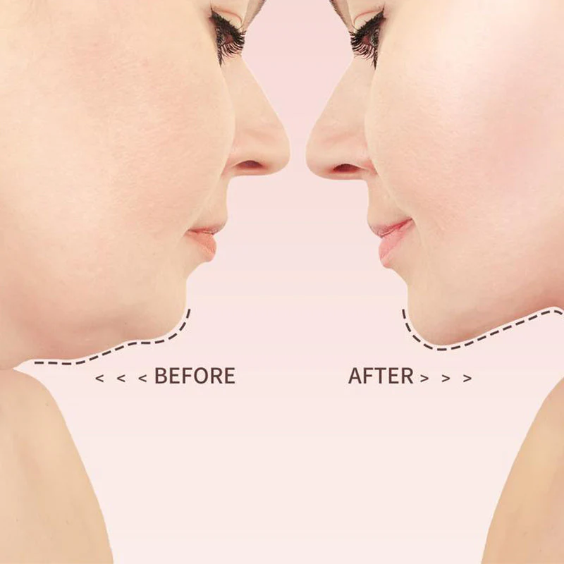 V Line Face Lifting Strap - Image 5