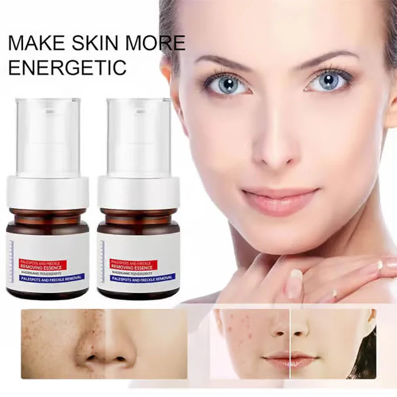 Vitamin C Whitening Freckles Face Cream - Image 6