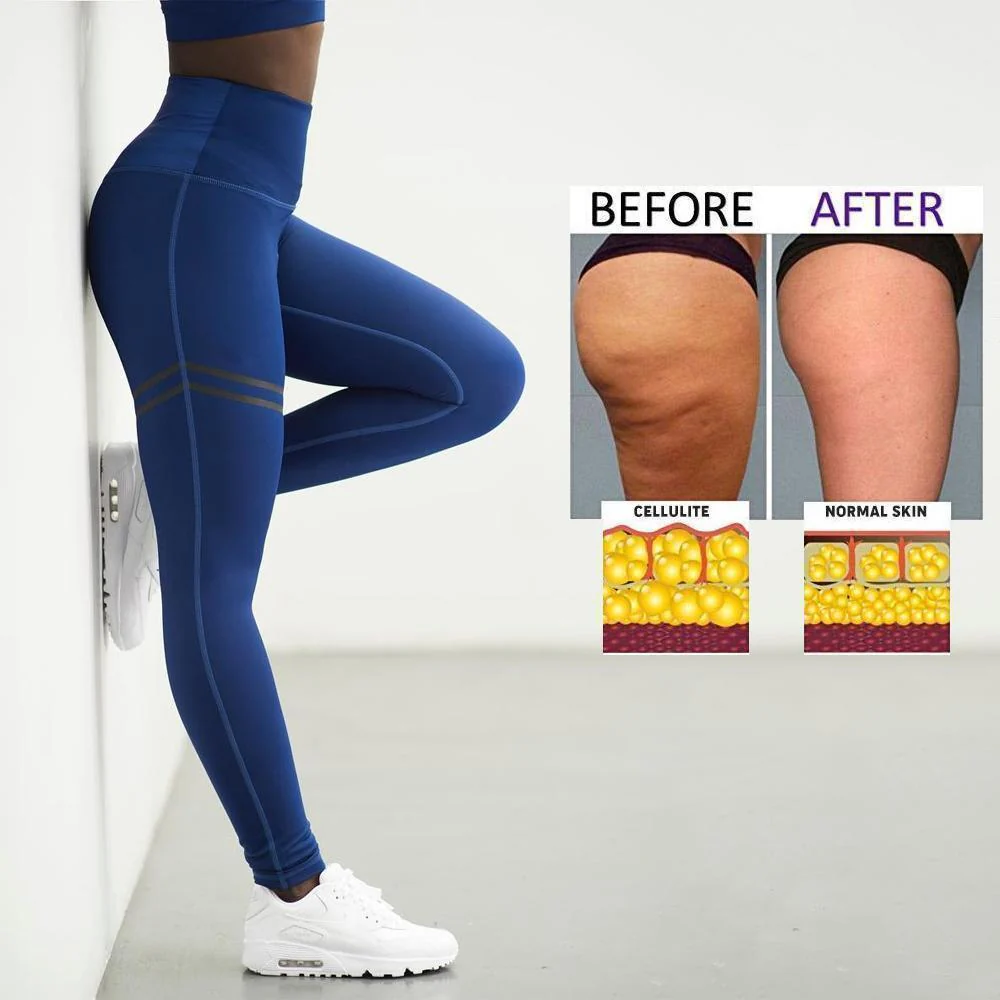 Women's Anti-cellulite Compression Leggings - Image 4